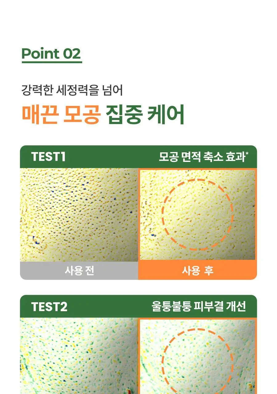 [블랙헤드/모공세정] 닥터지 그린딥 포어 클렌징밤 100ml 더블/단품 상세페이지 23